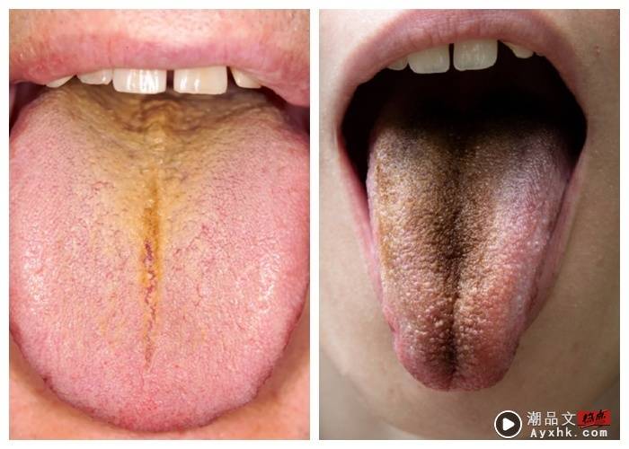 健康I 舌头没舌苔反而不行？舌苔6颜色状况一次看！ 更多热点 图2张